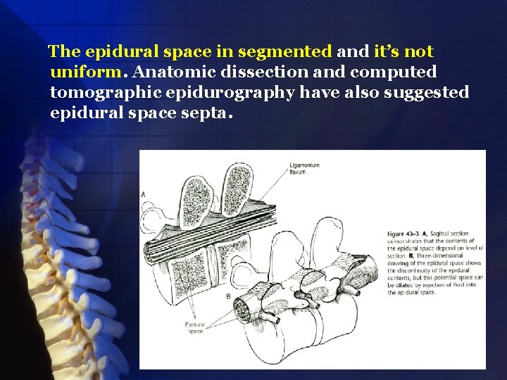The epidural space in segmented and it’s not uniform. Anatomic dissection and computed tomographic
