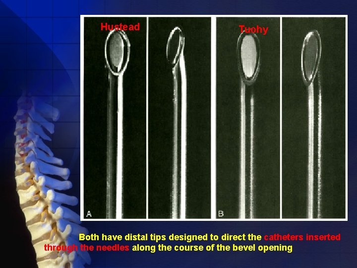 Hustead Tuohy Both have distal tips designed to direct the catheters inserted through the