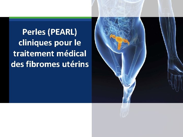  Perles (PEARL) cliniques pour le traitement médical des fibromes utérins 