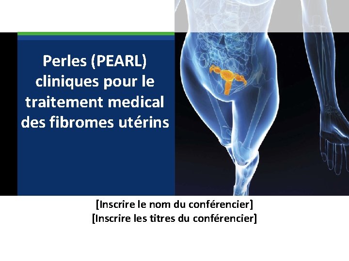  Perles (PEARL) cliniques pour le traitement medical des fibromes utérins [Inscrire le nom