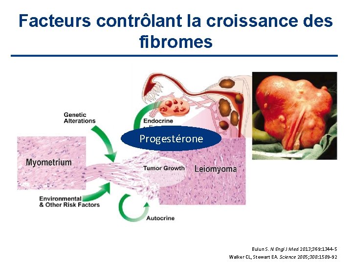 Facteurs contrôlant la croissance des fibromes Progestérone Bulun S. N Engl J Med 2013;