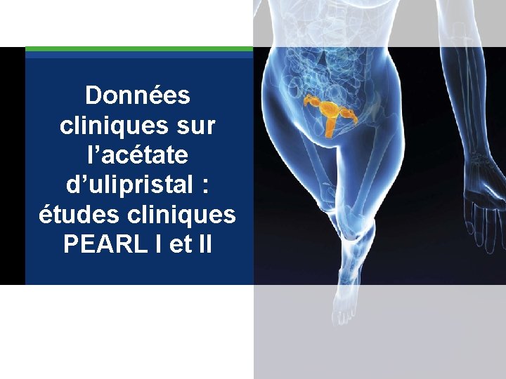  Données cliniques sur l’acétate d’ulipristal : études cliniques PEARL I et II 