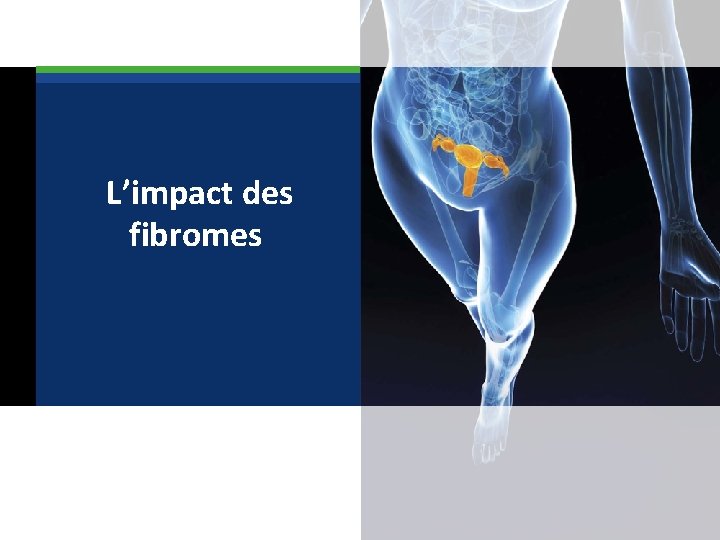  L’impact des fibromes 