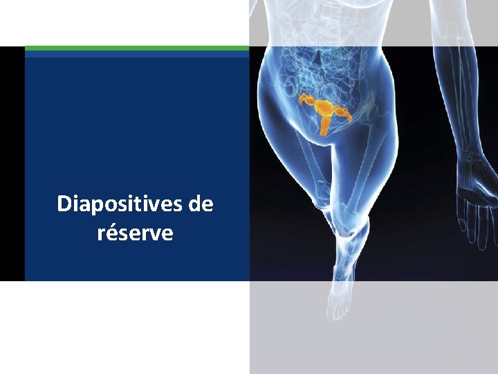  Diapositives de réserve 