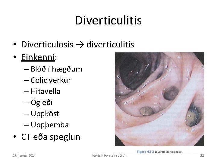 Diverticulitis • Diverticulosis → diverticulitis • Einkenni: – Blóð í hægðum – Colic verkur