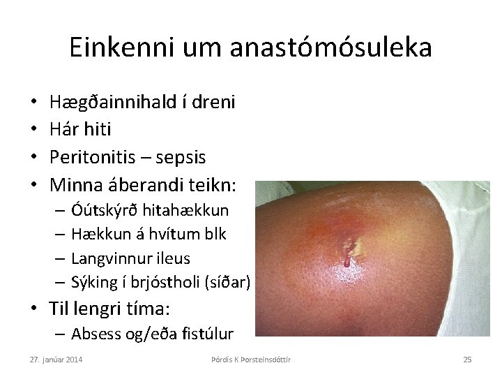 Einkenni um anastómósuleka • • Hægðainnihald í dreni Hár hiti Peritonitis – sepsis Minna
