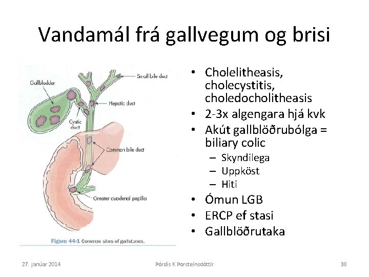 Vandamál frá gallvegum og brisi • Cholelitheasis, cholecystitis, choledocholitheasis • 2 -3 x algengara