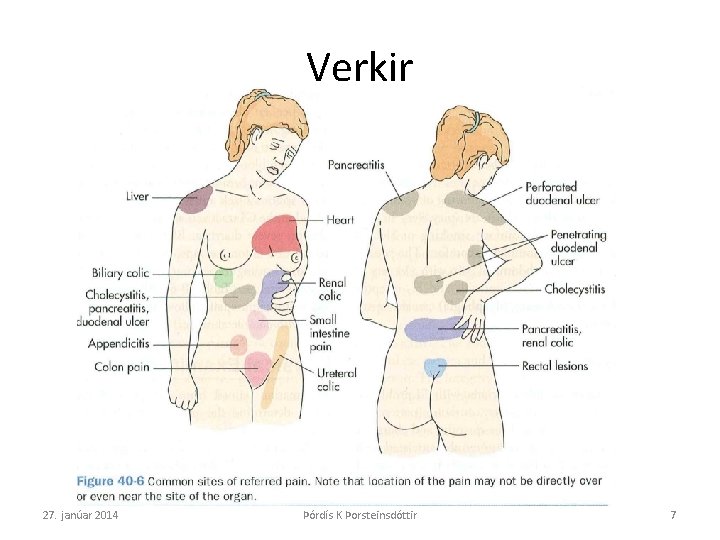 Verkir 27. janúar 2014 Þórdís K Þorsteinsdóttir 7 