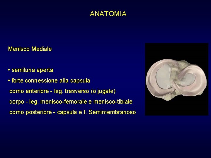 ANATOMIA Menisco Mediale • semiluna aperta • forte connessione alla capsula corno anteriore - ANATOMIA Menisco Mediale • semiluna aperta • forte connessione alla capsula corno anteriore -
