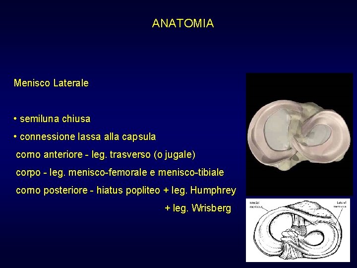 ANATOMIA Menisco Laterale • semiluna chiusa • connessione lassa alla capsula corno anteriore - ANATOMIA Menisco Laterale • semiluna chiusa • connessione lassa alla capsula corno anteriore -