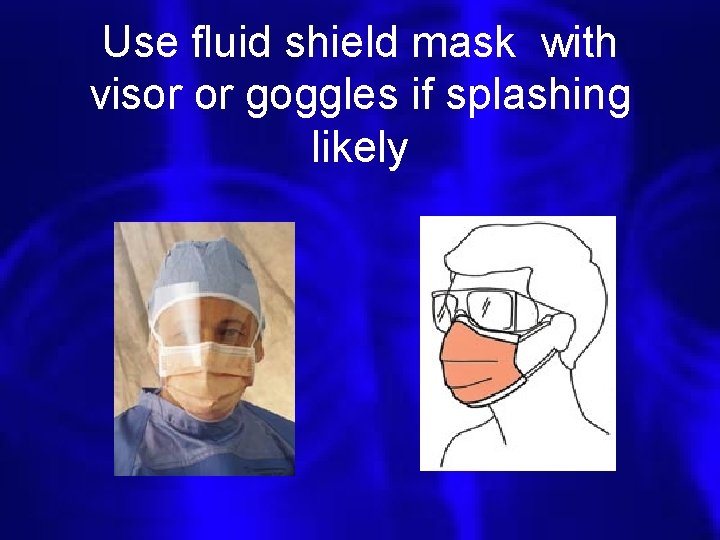 Use fluid shield mask with visor or goggles if splashing likely 