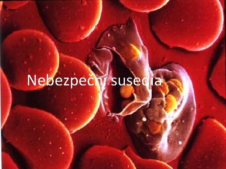 Nebezpeční susedia 