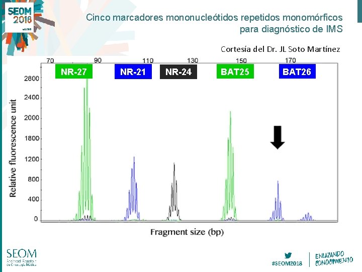 Cinco marcadores mononucleótidos repetidos monomórficos para diagnóstico de IMS Cortesía del Dr. JL Soto Cinco marcadores mononucleótidos repetidos monomórficos para diagnóstico de IMS Cortesía del Dr. JL Soto