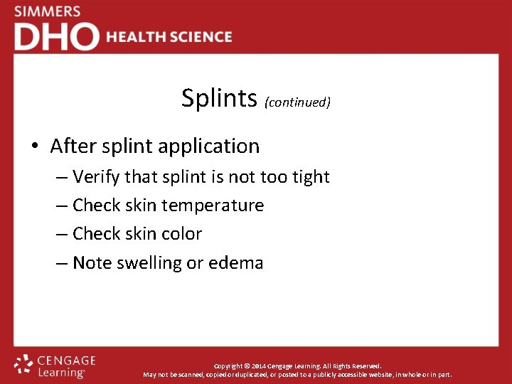 Splints (continued) • After splint application – Verify that splint is not too tight