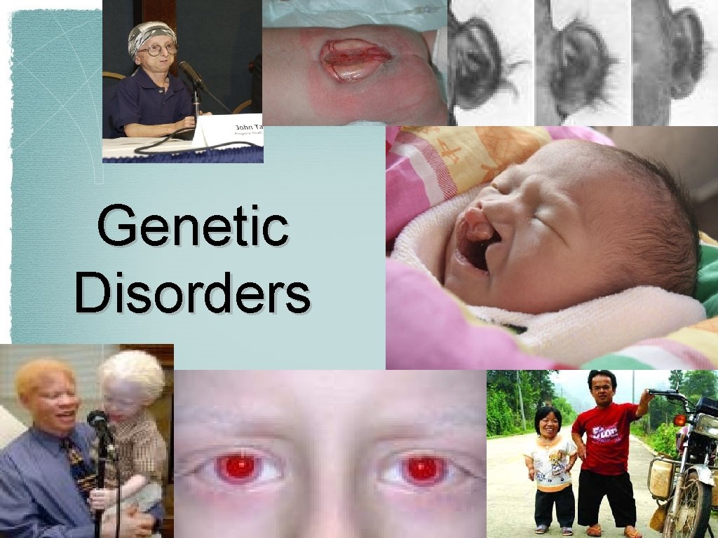 Genetic Disorders 