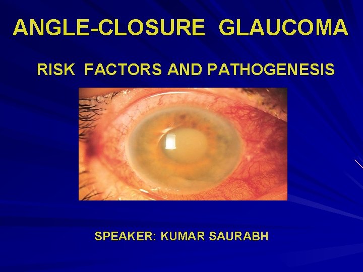 ANGLE-CLOSURE GLAUCOMA RISK FACTORS AND PATHOGENESIS SPEAKER: KUMAR SAURABH ANGLE-CLOSURE GLAUCOMA RISK FACTORS AND PATHOGENESIS SPEAKER: KUMAR SAURABH
