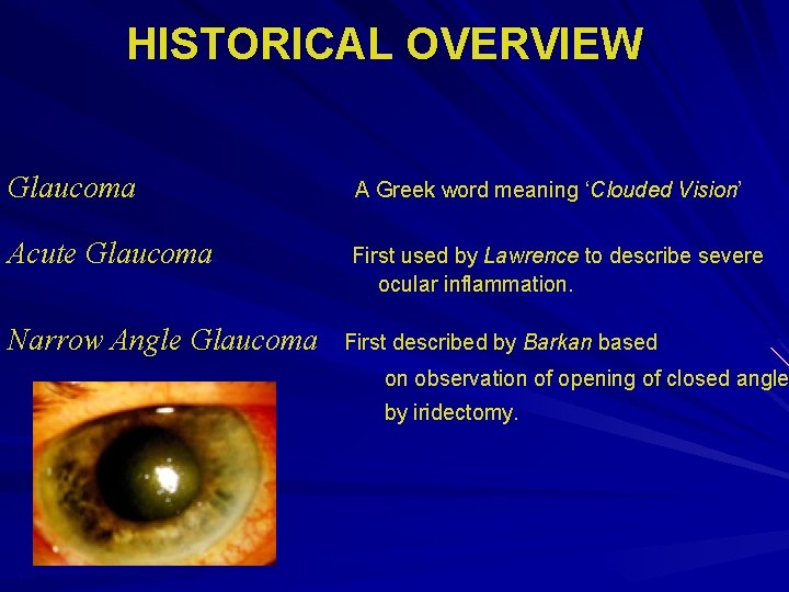 HISTORICAL OVERVIEW Glaucoma A Greek word meaning ‘Clouded Vision’ Acute Glaucoma First used by HISTORICAL OVERVIEW Glaucoma A Greek word meaning ‘Clouded Vision’ Acute Glaucoma First used by
