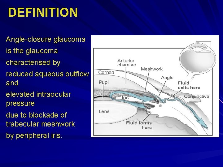 DEFINITION Angle-closure glaucoma is the glaucoma characterised by reduced aqueous outflow and elevated intraocular DEFINITION Angle-closure glaucoma is the glaucoma characterised by reduced aqueous outflow and elevated intraocular