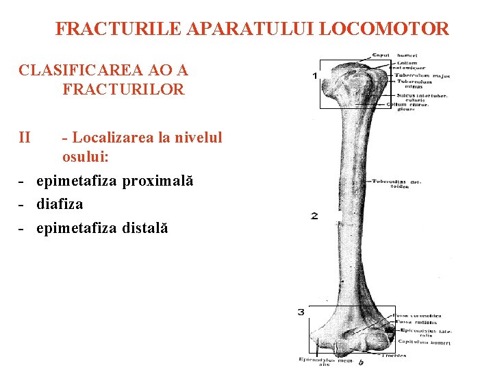 FRACTURILE APARATULUI LOCOMOTOR CLASIFICAREA АО A FRACTURILOR II Localizarea la nivelul osului: epimetafiza proximală