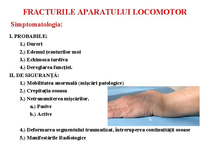 FRACTURILE APARATULUI LOCOMOTOR Simptomatologia: I. PROBABILE: 1. ) Dureri 2. ) Edemul ţesuturilor moi