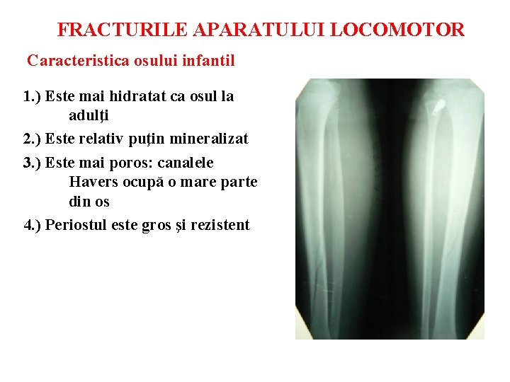 FRACTURILE APARATULUI LOCOMOTOR Caracteristica osului infantil 1. ) Este mai hidratat ca osul la