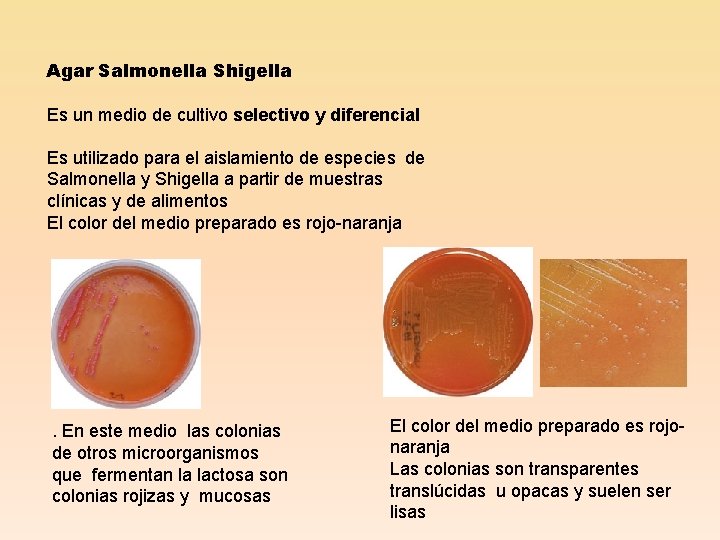 Agar Salmonella Shigella Es un medio de cultivo selectivo y diferencial Es utilizado para