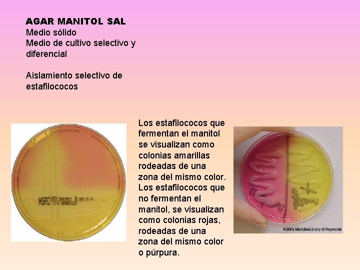 AGAR MANITOL SAL Medio sólido Medio de cultivo selectivo y diferencial Aislamiento selectivo de