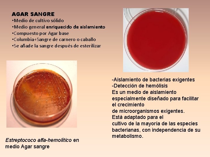 AGAR SANGRE • Medio de cultivo sólido • Medio general enriquecido de aislamiento •