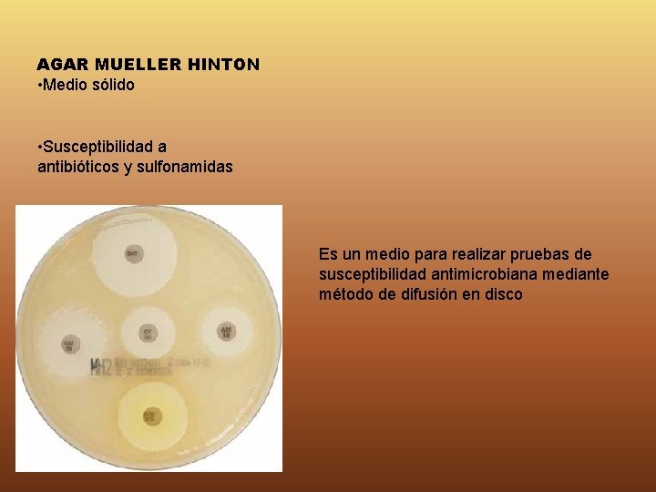 AGAR MUELLER HINTON • Medio sólido • Susceptibilidad a antibióticos y sulfonamidas Es un