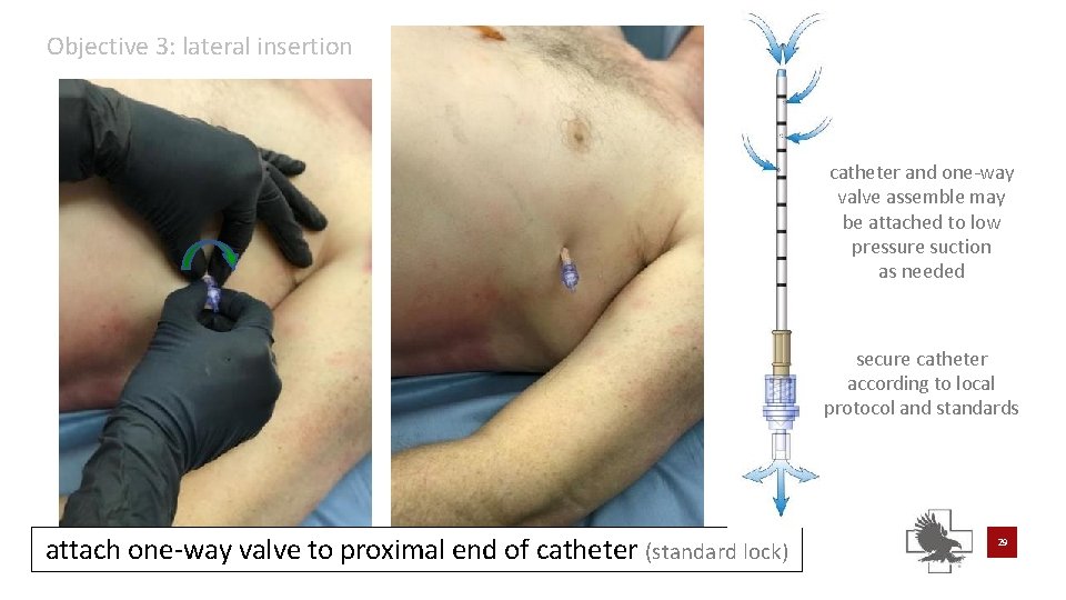 Objective 3: lateral insertion catheter and one-way valve assemble may be attached to low Objective 3: lateral insertion catheter and one-way valve assemble may be attached to low