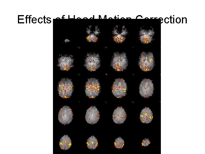 Effects of Head Motion Correction 