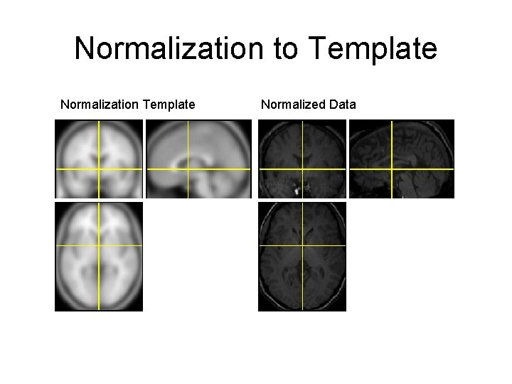 Normalization to Template Normalization Template Normalized Data 