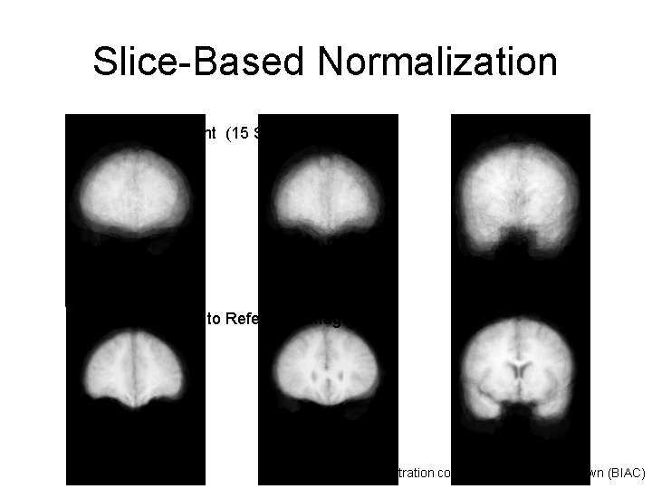 Slice-Based Normalization Before Adjustment (15 Subjects) After Adjustment to Reference Image Registration courtesy Dr.
