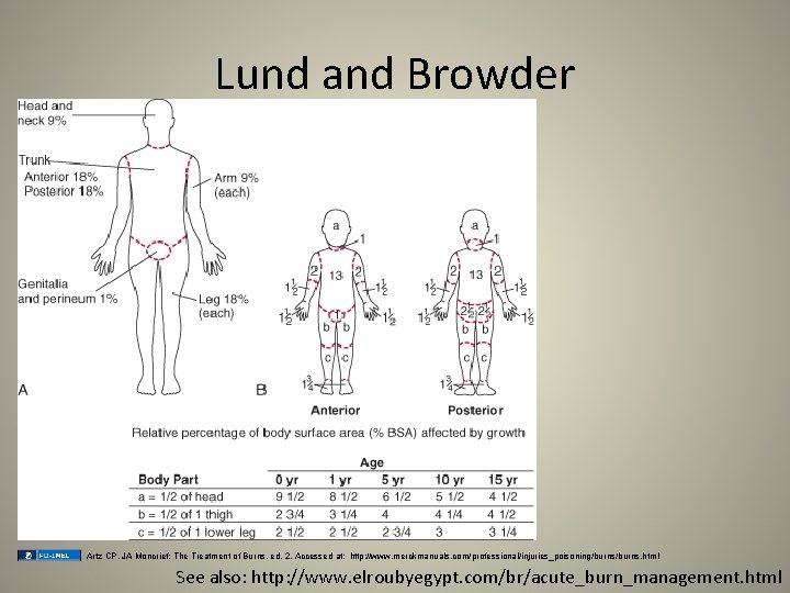 Lund and Browder Artz CP, JA Moncrief: The Treatment of Burns, ed. 2. Accessed