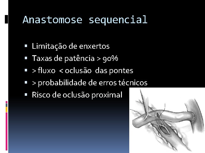 Anastomose sequencial Limitação de enxertos Taxas de patência > 90% > fluxo < oclusão