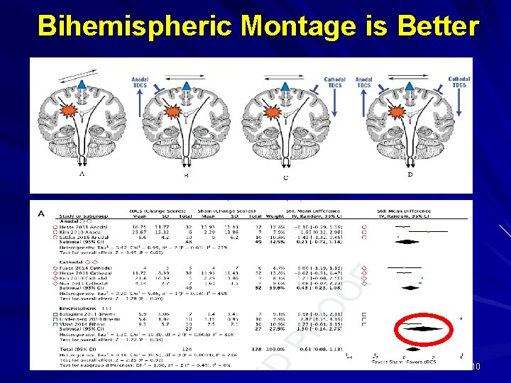 Bihemispheric Montage is Better 10 