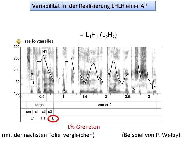 Variabilität in der Realisierung LHLH einer AP ses fontanelles = L 1 H 1