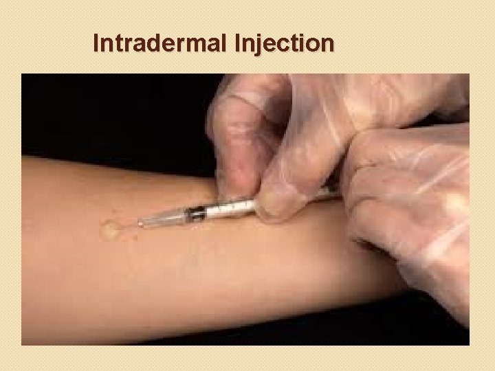 Intradermal Injection 