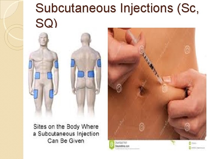 Subcutaneous Injections (Sc, SQ) 