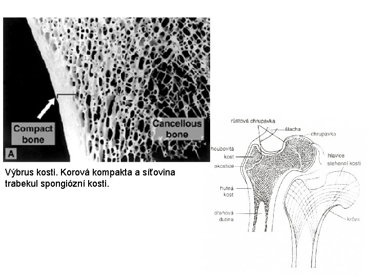 Výbrus kosti. Korová kompakta a síťovina trabekul spongiózní kosti. 