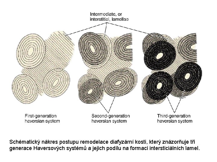 Schématický nákres postupu remodelace diafyzární kosti, který znázorňuje tři generace Haversových systémů a jejich