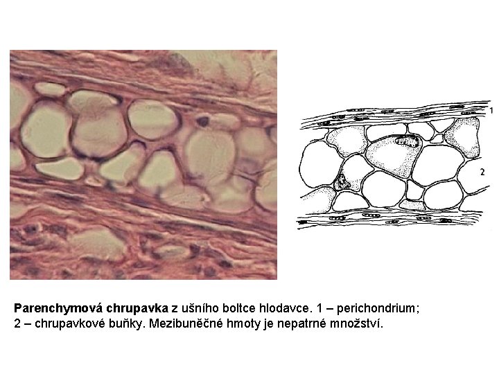 Parenchymová chrupavka z ušního boltce hlodavce. 1 – perichondrium; 2 – chrupavkové buňky. Mezibuněčné