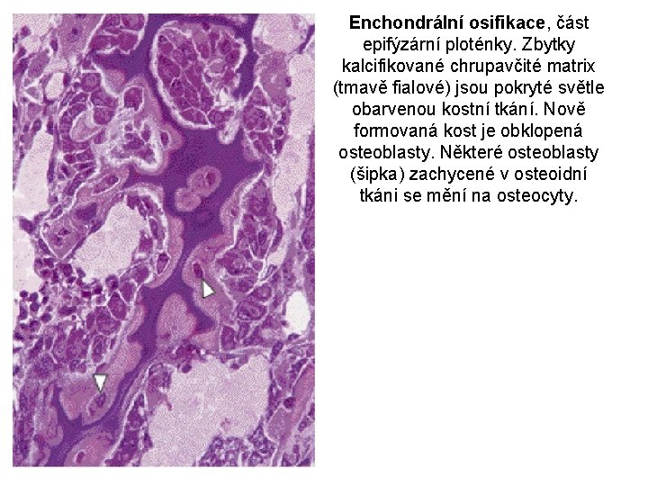 Enchondrální osifikace, část epifýzární ploténky. Zbytky kalcifikované chrupavčité matrix (tmavě fialové) jsou pokryté světle