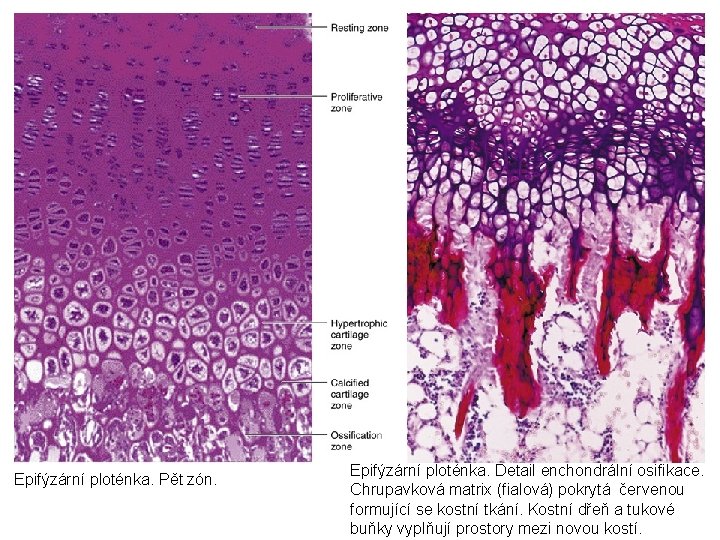 Epifýzární ploténka. Pět zón. Epifýzární ploténka. Detail enchondrální osifikace. Chrupavková matrix (fialová) pokrytá červenou