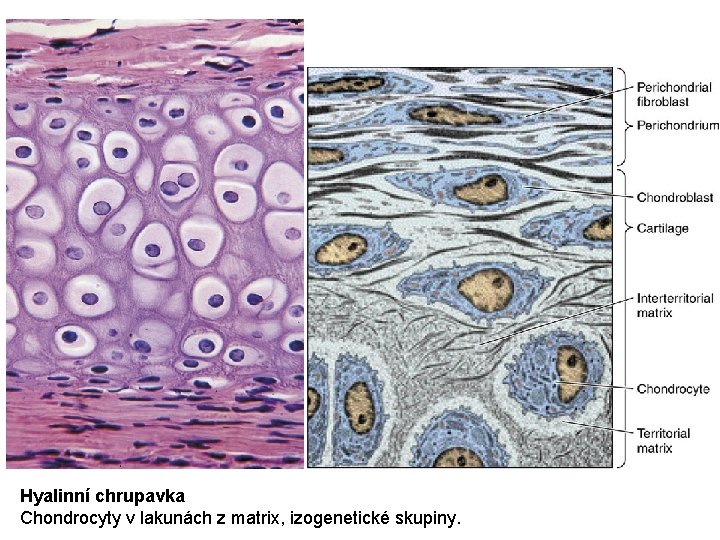 Hyalinní chrupavka Chondrocyty v lakunách z matrix, izogenetické skupiny. 