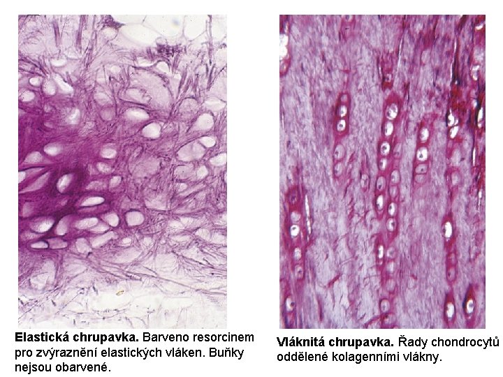 Elastická chrupavka. Barveno resorcinem pro zvýraznění elastických vláken. Buňky nejsou obarvené. Vláknitá chrupavka. Řady