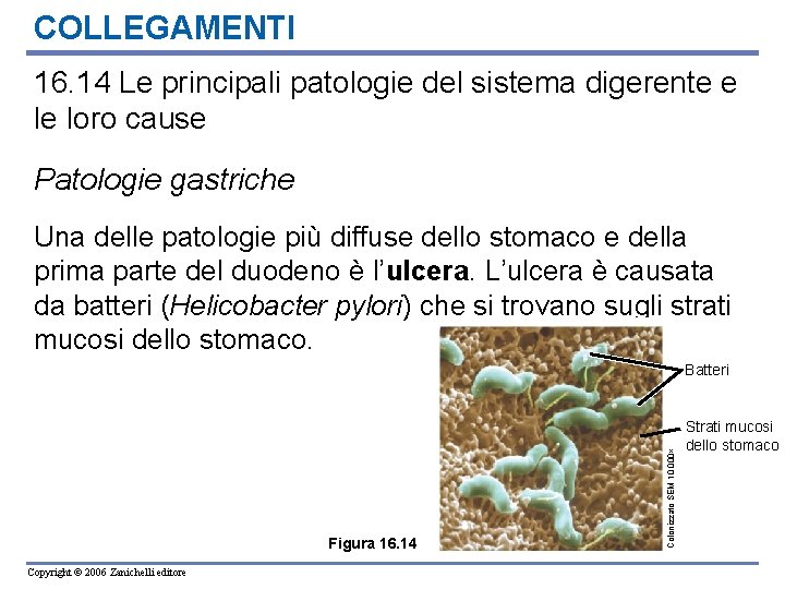 COLLEGAMENTI 16. 14 Le principali patologie del sistema digerente e le loro cause Patologie