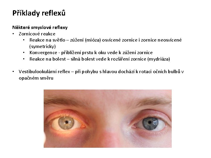 Příklady reflexů Některé smyslové reflexy • Zornicové reakce • Reakce na světlo – zúžení