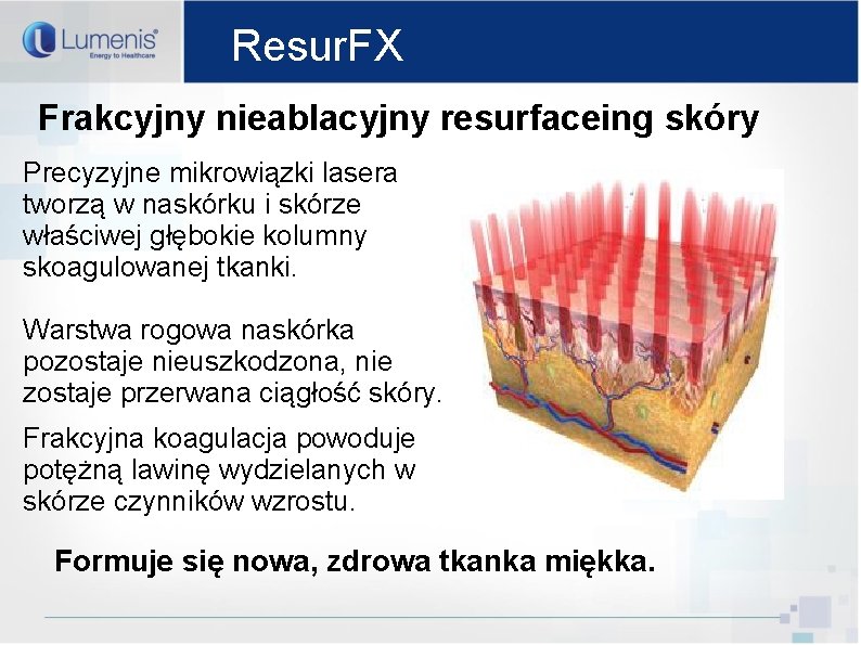 Resur. FX Frakcyjny nieablacyjny resurfaceing skóry Precyzyjne mikrowiązki lasera tworzą w naskórku i skórze