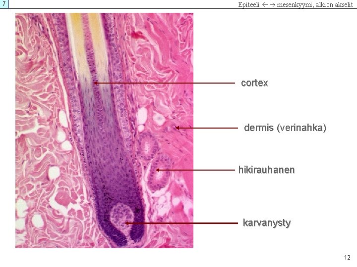 7 Epiteeli mesenkyymi, alkion akselit cortex dermis (verinahka) hikirauhanen karvanysty 12 